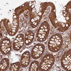 Immunohistochemical staining of human colon shows strong cytoplasmic positivity in glandular cells.