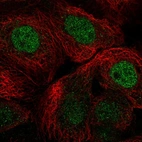 Immunofluorescent staining of human cell line A-431 shows localization to nucleoplasm.