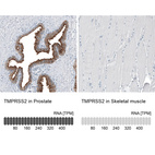 Anti-TMPRSS2 Antibody