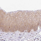 Immunohistochemical staining of human skin shows weak to moderate cytoplasmic positivity in squamous epithelial cells.