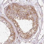 Immunohistochemical staining of human testis shows weak to moderate cytoplasmic positivity in cells in seminiferous ducts.