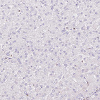 Immunohistochemical staining of human liver shows no positivity in hepatocytes as expected.