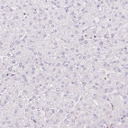 Immunohistochemical staining of human liver shows no positivity in hepatocytes as expected.