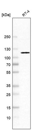 Western blot analysis in human cell line RT-4.