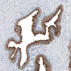 Immunohistochemical staining of human prostate shows strong membranous positivity in glandular cells.