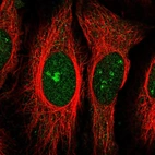 Immunofluorescent staining of human cell line HeLa shows localization to nucleus & nucleoli.