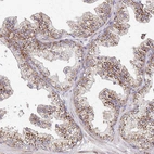 Immunohistochemical staining of human prostate shows strong positivity in cytoplasm granular in glandular cells.