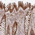 Immunohistochemical staining of human rectum shows strong positivity in cytoplasm granular in glandular cells.