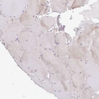 Immunohistochemical staining of human skeletal muscle shows low positivity as expected.