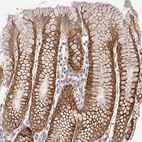 Immunohistochemical staining of human stomach shows strong positivity in cytoplasm granular in glandular cells.