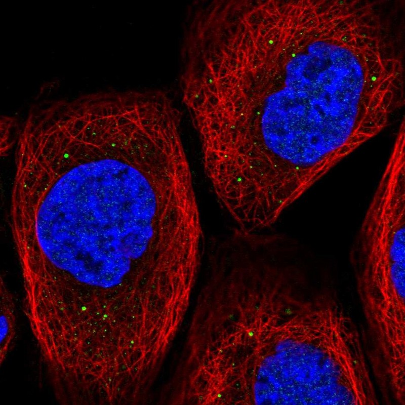 Anti-TIPRL Antibody