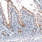 Immunohistochemical staining of human small intestine shows moderate to strong membranous positivity in glandular cells.