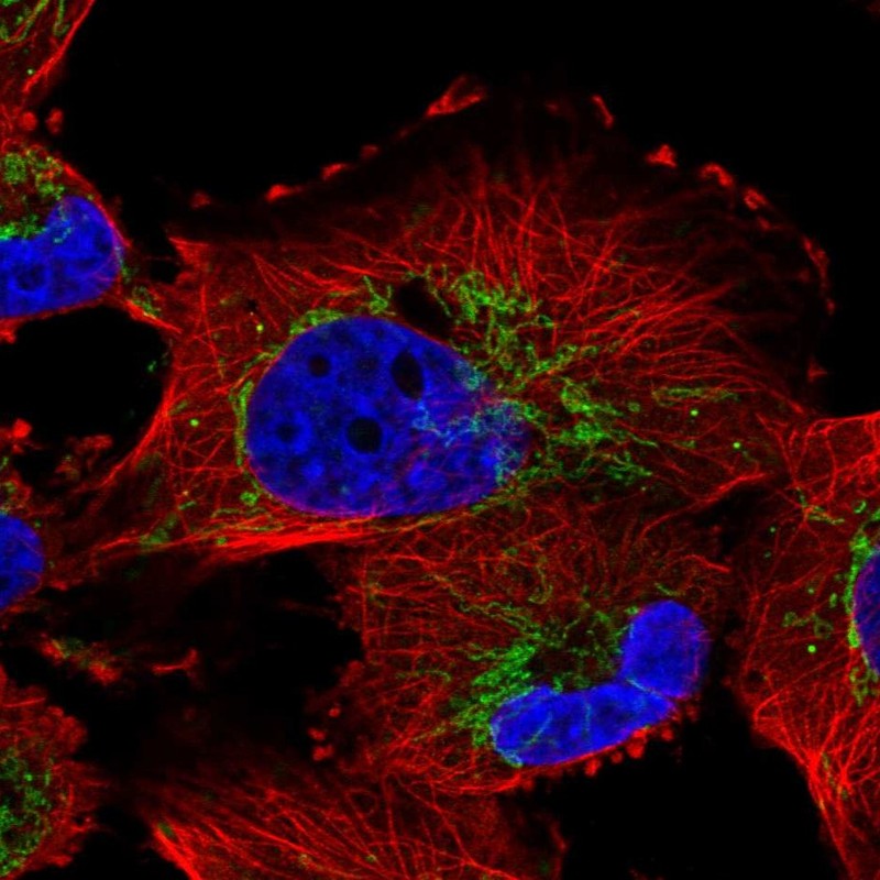 Anti-NME7 Antibody