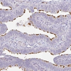 Immunohistochemical staining of human fallopian tube shows high expression.