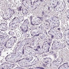 Immunohistochemical staining of human placenta shows low expression as expected.