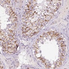 Anti-FNDC7 Antibody