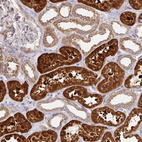 Immunohistochemical staining of human Kidney shows strong cytoplasmic positivity in cells in tubules.