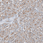 Anti-TMPRSS2 Antibody