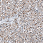 Immunohistochemical staining of human pancreas shows moderate membranous positivity in exocrine glandular cells.