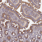 Immunohistochemical staining of human Small intestine shows moderate cytoplasmic positivity in glandular cells.