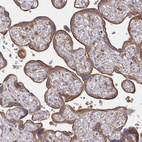 Immunohistochemical staining of human Placenta shows moderate cytoplasmic positivity in trophoblastic cells.