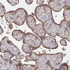 Immunohistochemical staining of human Placenta shows moderate cytoplasmic positivity in trophoblastic cells.
