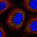 Immunofluorescent staining of human cell line A-431 shows localization to vesicles.