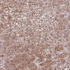 Anti-NTPCR Antibody