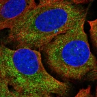 Immunofluorescent staining of human cell line U-2 OS shows localization to cytosol.