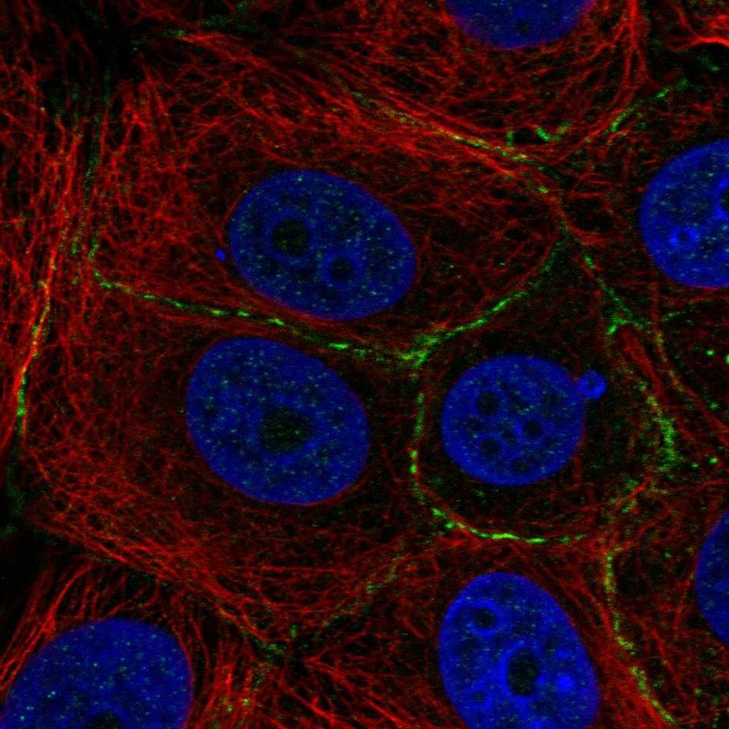 Anti-PLEKHA6 Antibody