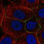 Anti-PLEKHA6 Antibody