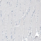 Immunohistochemical staining of human skeletal muscle shows no positivity in myocytes as expected.