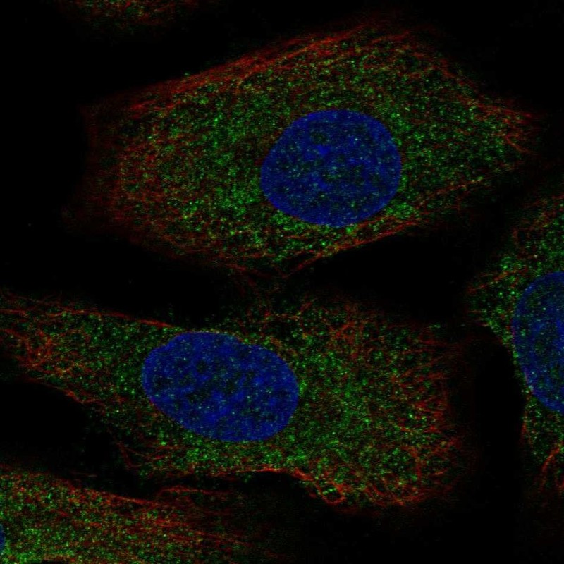Anti-AANAT Antibody