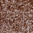 Anti-BLVRA Antibody