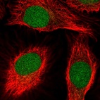 Anti-SCNM1 Antibody