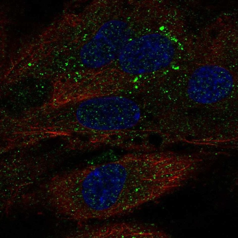 Anti-TDRD10 Antibody