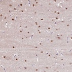 Anti-TAF1A Antibody