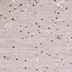 Anti-TAF1A Antibody