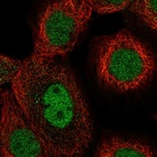 Immunofluorescent staining of human cell line A-431 shows localization to nucleoplasm.