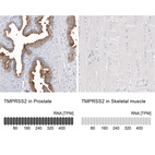 Anti-TMPRSS2 Antibody