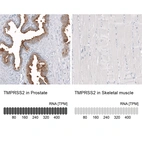 Anti-TMPRSS2 Antibody