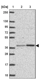 Lane 1: Marker [kDa] 250, 130, 95, 72, 55, 36, 28, 17, 10_br/_Lane 2: Human cell line RT-4_br/_Lane 3: Human cell line U-251MG sp