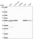 Western blot analysis in human cell line RT-4, human cell line U-251 MG, human plasma, human liver tissue and human tonsil tissue.