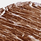 Immunohistochemical staining of human heart muscle shows high expression.
