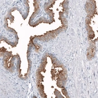Immunohistochemical staining of human prostate shows strong membranous positivity in glandular cells.