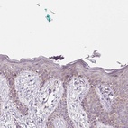 Immunohistochemical staining of human skin shows low expression as expected.