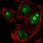 Anti-ZNF593 Antibody