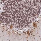 Anti-NDUFAB1 Antibody