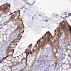 Anti-TAS2R38 Antibody