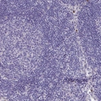 Immunohistochemical staining of human lymph node shows negative cytoplasmic positivity in germinal center cells and non-germinal center cells as expected.